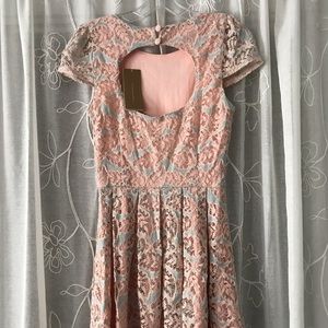 Francesca’s Lace Dress